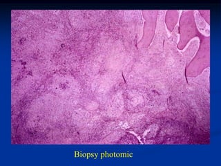 Biopsy photomic
 