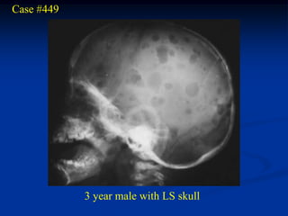 Case #449




            3 year male with LS skull
 
