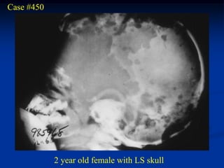 Case #450




            2 year old female with LS skull
 