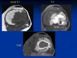 Axial T-1   T-2




     Gad
 