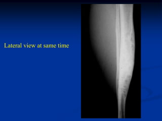 Lateral view at same time
 