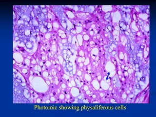 Photomic showing physaliferous cells
 
