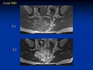 Axial MRI




     T-1




      T-2
 
