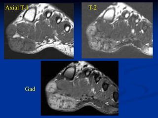 Axial T-1    T-2




       Gad
 