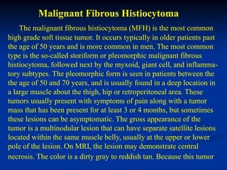 Malignant Fibrous Histiocytoma
    The malignant fibrous histiocytoma (MFH) is the most common
high grade soft tissue tumor. It occurs typically in older patients past
the age of 50 years and is more common in men. The most common
type is the so-called storiform or pleomorphic malignant fibrous
histiocytoma, followed next by the myxoid, giant cell, and inflamma-
tory subtypes. The pleomorphic form is seen in patients between the
the age of 50 and 70 years, and is usually found in a deep location in
a large muscle about the thigh, hip or retroperitoneal area. These
tumors usually present with symptoms of pain along with a tumor
mass that has been present for at least 3 or 4 months, but sometimes
these lesions can be asymptomatic. The gross appearance of the
tumor is a multinodular lesion that can have separate satellite lesions
located within the same muscle belly, usually at the upper or lower
pole of the lesion. On MRI, the lesion may demonstrate central
necrosis. The color is a dirty gray to reddish tan. Because this tumor
 