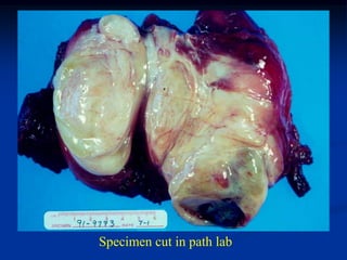 Specimen cut in path lab
 