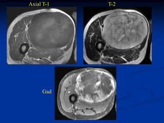Axial T-1   T-2




     Gad
 