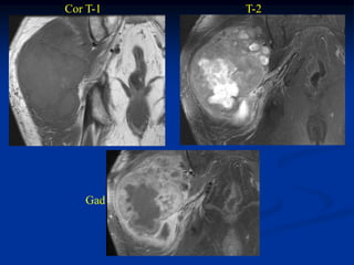 Cor T-1   T-2




   Gad
 