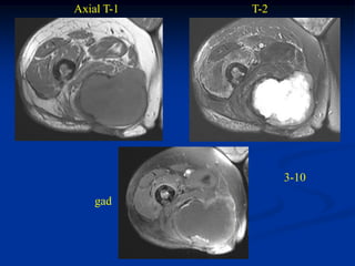 Axial T-1   T-2




                  3-10

    gad
 