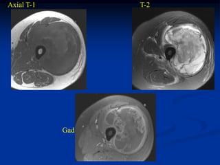 Axial T-1         T-2




            Gad
 
