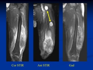 Cor STIR   Ant STIR   Gad
 