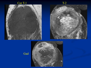 Cor T-1   T-2




    Gad
 