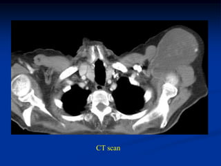 CT scan
 