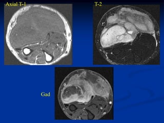 Axial T-1         T-2




            Gad
 