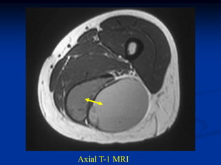 Axial T-1 MRI
 