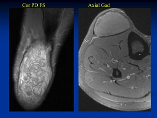 Cor PD FS   Axial Gad
 