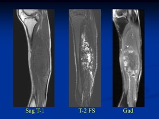 Sag T-1   T-2 FS   Gad
 
