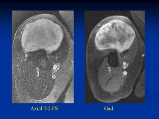 Axial T-2 FS   Gad
 