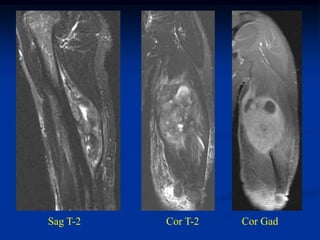 Sag T-2   Cor T-2   Cor Gad
 