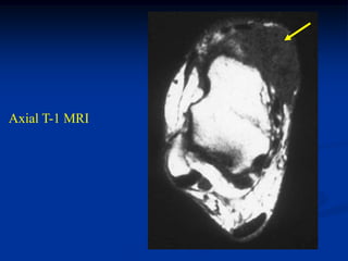 Axial T-1 MRI
 