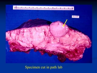 Specimen cut in path lab
 