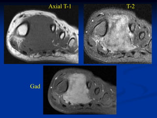 Axial T-1   T-2




Gad
 