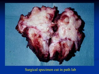 Surgical specimen cut in path lab
 