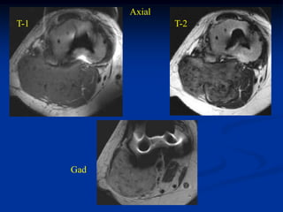 Axial
T-1                 T-2




      Gad
 