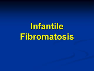 Infantile
Fibromatosis
 