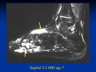 Sagittal T-2 MRI age 7
 