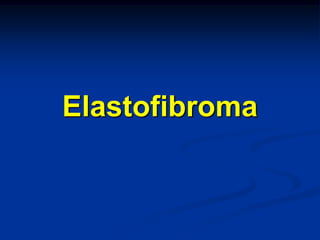 Elastofibroma
 