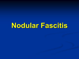 Nodular Fascitis
 