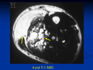Axial T-1 MRI
 