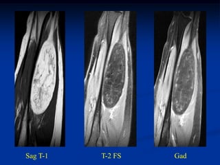 Sag T-1   T-2 FS   Gad
 