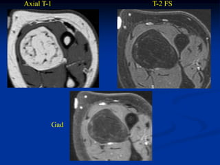 Axial T-1     T-2 FS




        Gad
 