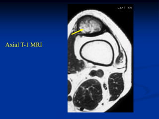 Axial T-1 MRI
 