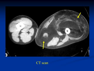 CT scan
 