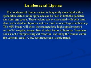Lumbosacral Lipoma
   The lumbosacral lipoma variant is frequently associated with a
spinabifida defect in the spine and can be seen in both the pediatric
and adult age group. These lesions can be associated with both intra-
dural and extradural lipomas and can result in neurological deficiency.
The MRI image will show the characteristic high signal response
on the T-1 weighed image, like all other forms of lipomas. Treatment
consists of a marginal surgical resection, including the lesions within
the vertebral canal. A low recurrence rate is anticipated.
 