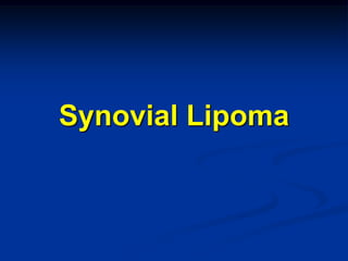 Synovial Lipoma
 