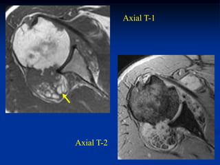 Axial T-1




Axial T-2
 