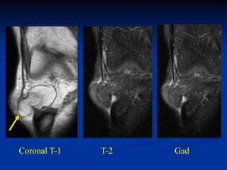 Coronal T-1   T-2   Gad
 