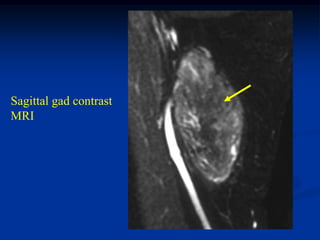 Sagittal gad contrast
MRI
 