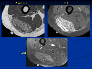 Axial T-1   PD




    Gad
 