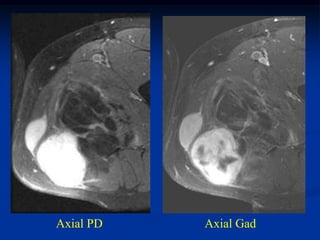 Axial PD   Axial Gad
 