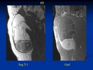 09




Sag T-1        Gad
 