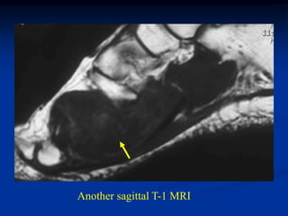 Another sagittal T-1 MRI
 