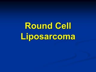 Round Cell
Liposarcoma
 