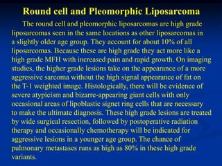Round cell and Pleomorphic Liposarcoma
    The round cell and pleomorphic liposarcomas are high grade
liposarcomas seen in the same locations as other liposarcomas in
a slightly older age group. They account for about 10% of all
liposarcomas. Because these are high grade they act more like a
high grade MFH with increased pain and rapid growth. On imaging
studies, the higher grade lesions take on the appearance of a more
aggressive sarcoma without the high signal appearance of fat on
the T-1 weighted image. Histologically, there will be evidence of
severe atypicism and bizarre-appearing giant cells with only
occasional areas of lipoblastic signet ring cells that are necessary
to make the ultimate diagnosis. These high grade lesions are treated
by wide surgical resection, followed by postoperative radiation
therapy and occasionally chemotherapy will be indicated for
aggressive lesions in a younger age group. The chance of
pulmonary metastases runs as high as 80% in these high grade
variants.
 