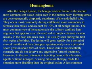 Hemangioma
   After the benign lipoma, the benign vascular tumor is the second
most common soft tissue lesion seen in the human body. Hemangiomas
are developmentally dysplastic neoplasms of the endothelial tube.
They occur most commonly during childhood, more commonly in
females than males, and account for 70% of all benign tumors. The
most common type of hemangioma is the solitary capillary hem-
angioma that appears as an elevated red to purple cutaneous lesion,
usually in the head and neck area. It is usually seen during the first
few weeks after birth. The lesion will grow rapidly for a period of
several months and then disappear spontaneously over a period of
seven years in about 80% of cases. These lesions are essentially
cosmetic and do not deserve any aggressive form of treatment.
However, in the past, attempts at injecting them with sclerosing
agents or liquid nitrogen, or using radiation therapy, made the
situation more disabling than the original lesion. A less common
 