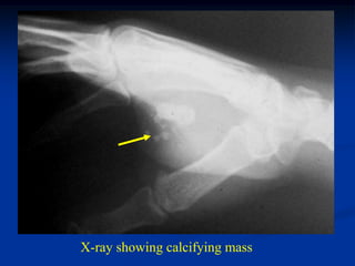 X-ray showing calcifying mass
 
